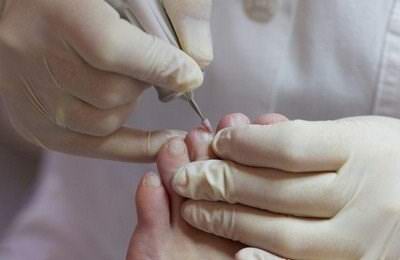 洛陽愛足康修腳堂|如何治療甲溝炎